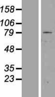 Western Blot: ZNF225 Overexpression Lysate [NBP2-07423]