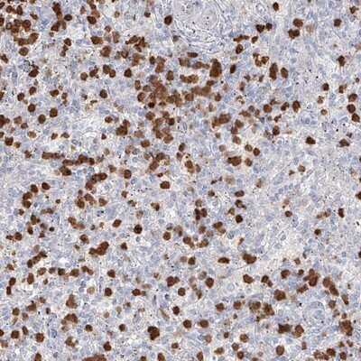 Immunohistochemistry-Paraffin: ZNF227 Antibody [NBP1-85930]