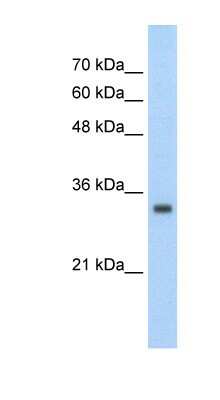 Western Blot: ZNF227 Antibody [NBP1-80194]