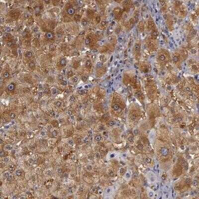 Immunohistochemistry-Paraffin: ZNF229 Antibody [NBP1-86175]