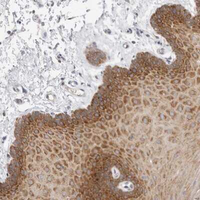 Immunohistochemistry-Paraffin: ZNF23 Antibody [NBP1-82867]