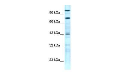 Western Blot: ZNF23 Antibody [NBP2-88657]