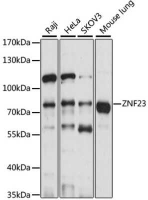 Western Blot: ZNF23 AntibodyAzide and BSA Free [NBP2-94684]