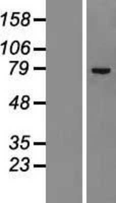 Western Blot: ZNF23 Overexpression Lysate [NBL1-18092]