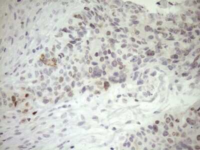 Immunohistochemistry: ZNF230 Antibody (OTI1E2) [NBP2-46425]