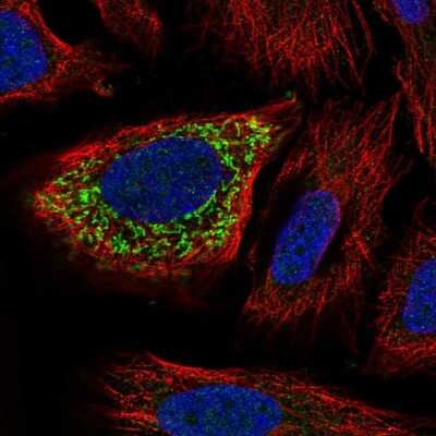 Immunocytochemistry/ Immunofluorescence: ZNF230 Antibody [NBP2-58880]