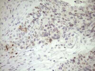 Immunohistochemistry: ZNF230 Antibody (OTI1E2) - Azide and BSA Free [NBP2-74934]