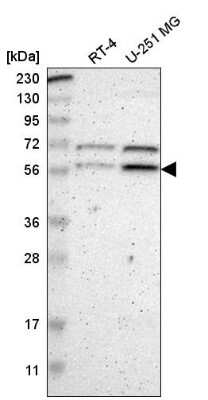 Western Blot: ZNF230 Antibody [NBP2-58880]