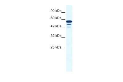 Western Blot: ZNF230 Antibody [NBP2-86462]