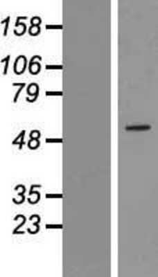 Western Blot: ZNF230 Overexpression Lysate [NBL1-18093]