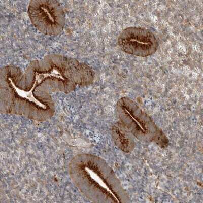 Immunohistochemistry-Paraffin: ZNF232 Antibody [NBP1-86822]