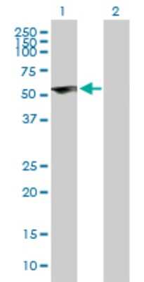 Western Blot: ZNF232 Antibody [H00007775-B01P]