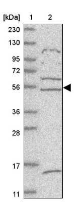 Western Blot: ZNF232 Antibody [NBP1-86822]