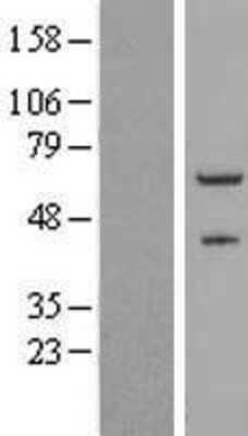 Western Blot: ZNF232 Overexpression Lysate [NBL1-18094]