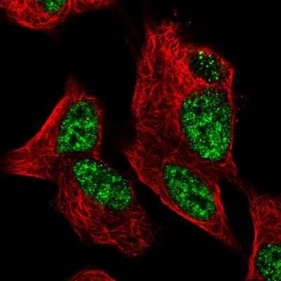 Immunocytochemistry/ Immunofluorescence: ZNF233 Antibody [NBP1-81942]