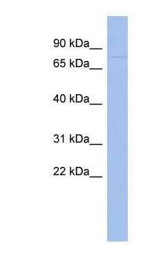 Western Blot: ZNF233 Antibody [NBP1-80192]