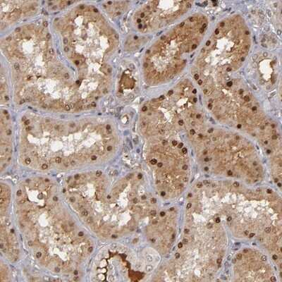 Immunohistochemistry-Paraffin: ZNF234 Antibody [NBP1-81631]