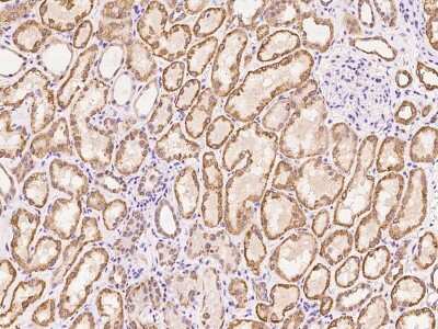 Immunohistochemistry-Paraffin: ZNF234 Antibody [NBP3-06253]