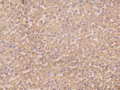 Immunohistochemistry-Paraffin: ZNF234 Antibody [NBP3-06253]