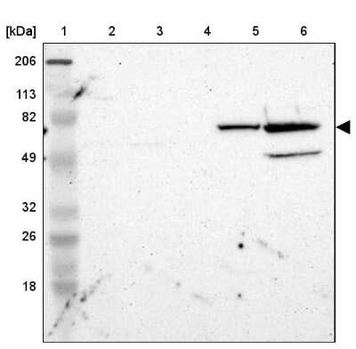 Western Blot: ZNF234 Antibody [NBP1-81631]