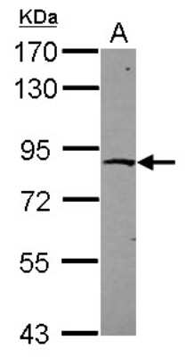 Western Blot: ZNF234 Antibody [NBP2-15167]