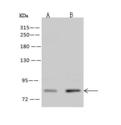 Western Blot: ZNF234 Antibody [NBP3-06253]