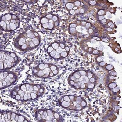 Immunohistochemistry-Paraffin: ZNF235 Antibody [NBP1-92619]
