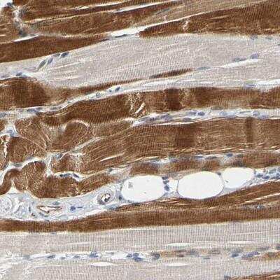 Immunohistochemistry: ZNF236 Antibody [NBP1-86486]