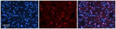 Immunohistochemistry-Paraffin: ZNF236 Antibody [NBP2-83838]