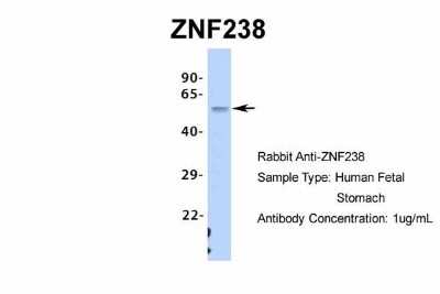 Western Blot: ZNF238 Antibody [NBP2-82381]