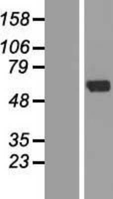 Western Blot: ZNF238 Overexpression Lysate [NBL1-18096]