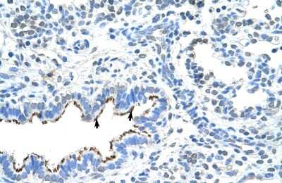 Immunohistochemistry: ZNF239 Antibody [NBP3-10375]