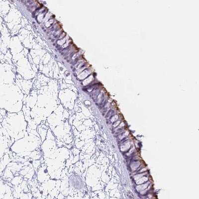 Immunohistochemistry-Paraffin: ZNF239 Antibody [NBP1-92620]