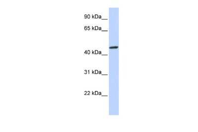 Western Blot: ZNF239 Antibody [NBP3-10456]