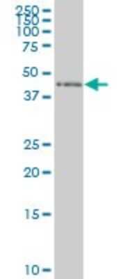 Western Blot: ZNF24 Antibody (2G5) [H00007572-M02]