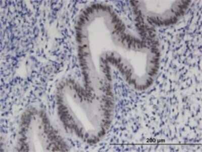 Immunohistochemistry-Paraffin: ZNF24 Antibody (4A1) [H00007572-M01]