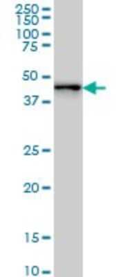 Western Blot: ZNF24 Antibody (4A1) [H00007572-M01]