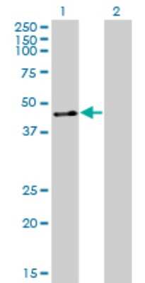 Western Blot: ZNF24 Antibody (4A1) [H00007572-M01]