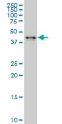 Western Blot: ZNF24 Antibody (4C2) [H00007572-M03]