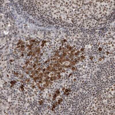 Immunohistochemistry-Paraffin: ZNF24 Antibody [NBP1-82866]