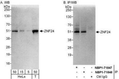 Western Blot: ZNF24 Antibody [NBP1-71847]