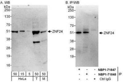 Western Blot: ZNF24 Antibody [NBP1-71848]