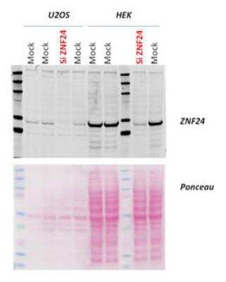 Western Blot: ZNF24 Antibody [NBP1-82866]