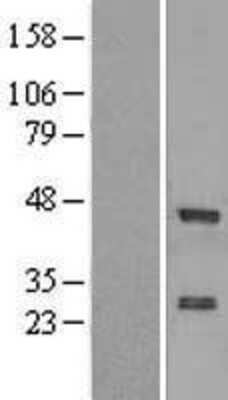 Western Blot: ZNF24 Overexpression Lysate [NBL1-18098]