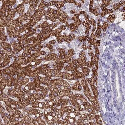 Immunohistochemistry: ZNF248 Antibody [NBP2-48538]