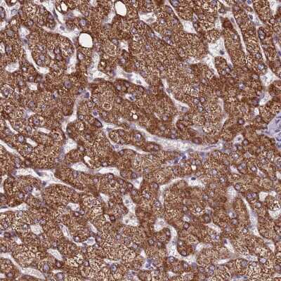Immunohistochemistry: ZNF248 Antibody [NBP2-48540]