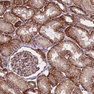 Immunohistochemistry-Paraffin: ZNF248 Antibody [NBP2-48539]