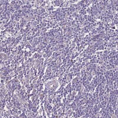 Immunohistochemistry-Paraffin: ZNF248 Antibody [NBP2-48540]