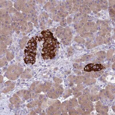 Immunohistochemistry-Paraffin: ZNF248 Antibody [NBP2-48540]