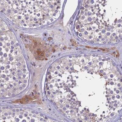 Immunohistochemistry-Paraffin: ZNF248 Antibody [NBP2-48540]